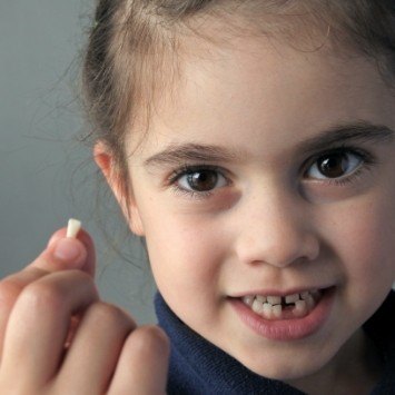 Little girl holding up extracted tooth
