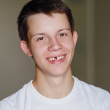 Preteen boy with knocked out permanent tooth
