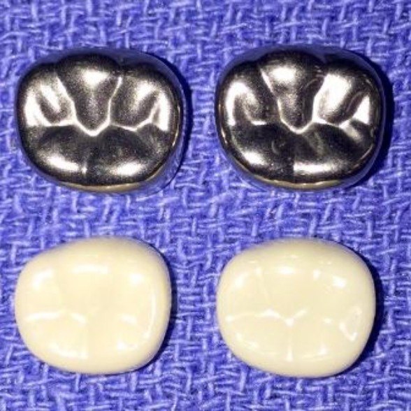 Stainless steel and white dental crown restorations prior to placement