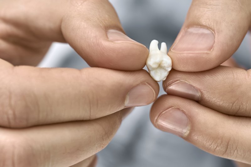 person holding a knocked-out tooth in Chesterfield