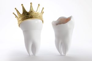 A fake tooth with a crown next to a broken fake tooth