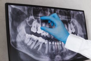 Dental X-ray.